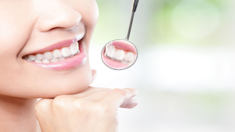 Teeth Implants In Adelaide: Advantages